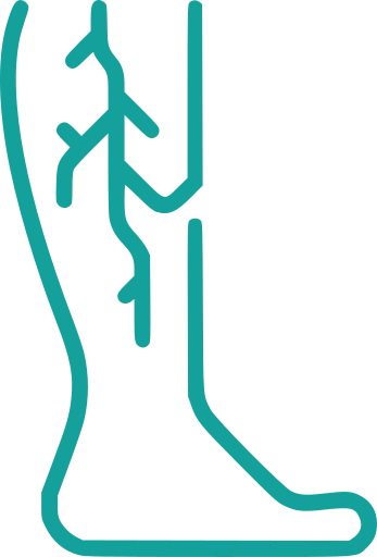 Vascular Surgery